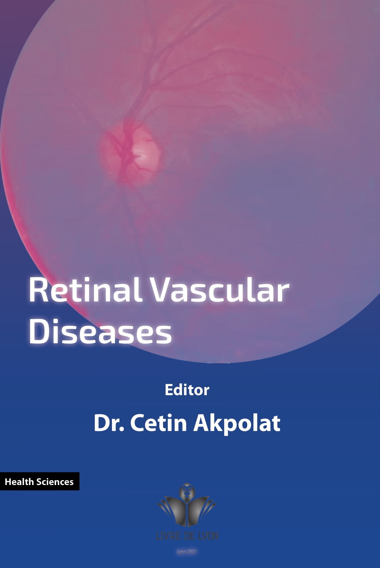 Retinal Vascular Diseases